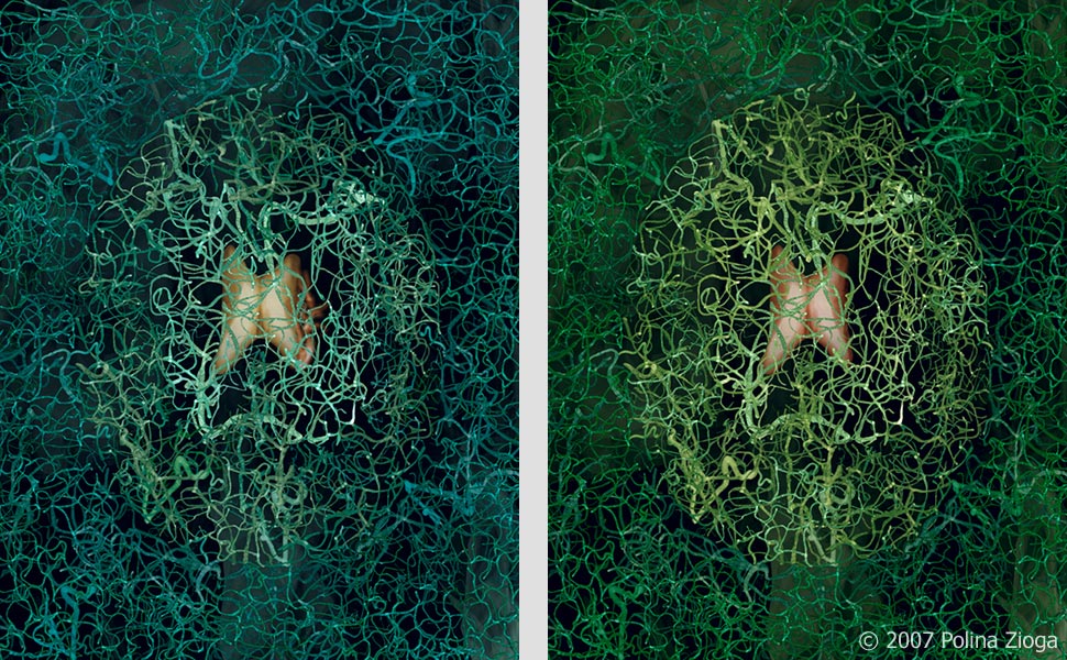 http://www.polina-zioga.com/files/gimgs/41_brain-angiography2.jpg