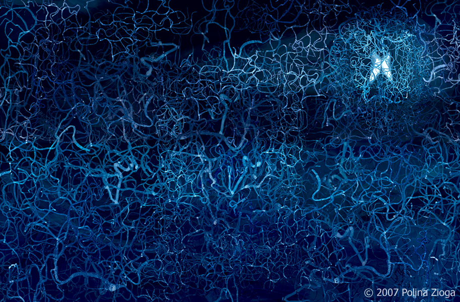 http://www.polina-zioga.com/files/gimgs/41_brain-angiography3_v2.jpg