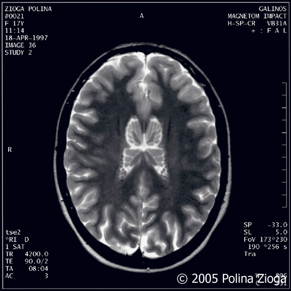 http://www.polina-zioga.com/files/gimgs/47_april1997-03.jpg