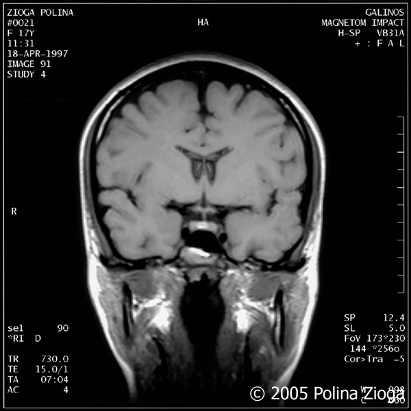 http://www.polina-zioga.com/files/gimgs/47_april1997-10.jpg