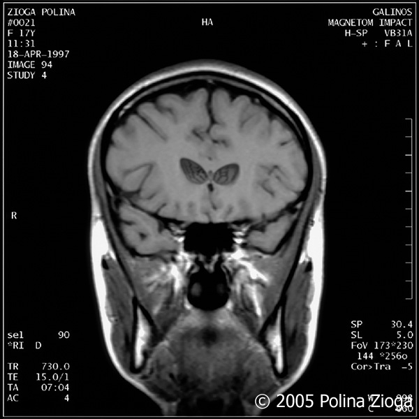 http://www.polina-zioga.com/files/gimgs/47_april1997-12.jpg